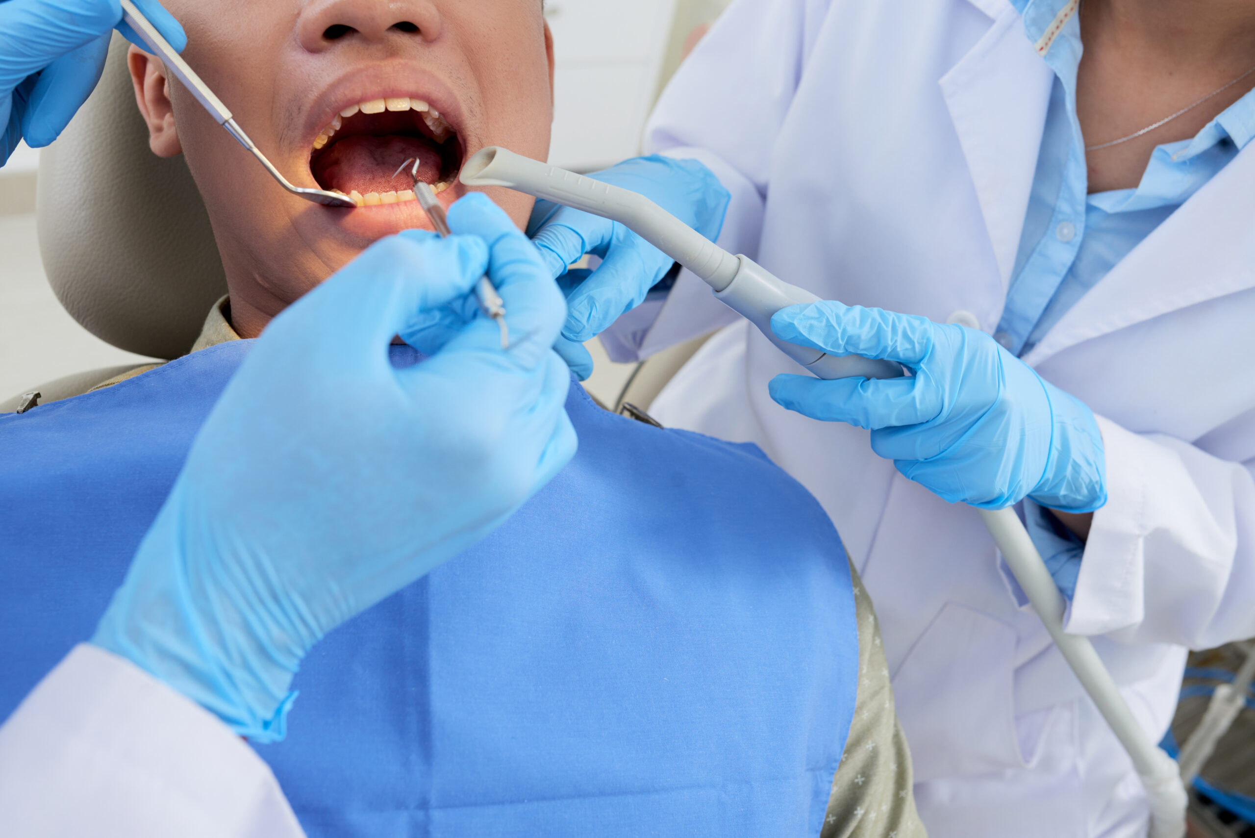 Asian young man opening his mouth widely when having teeth examination